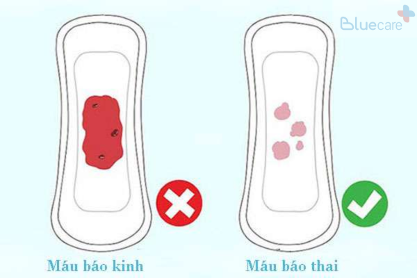mau-bao-thai